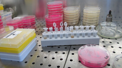 Polscy naukowcy współtwórcami sposobu na oporne bakterie