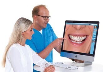 Romexis Smile Design