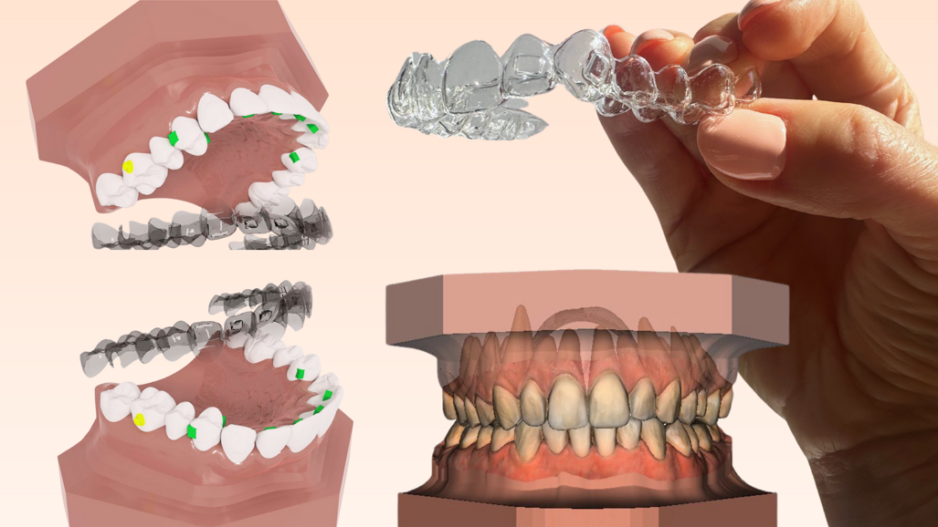 Polorto – Modele de diagnosticare DDP AI