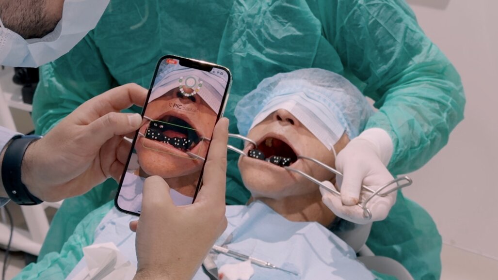 PIC app during capture