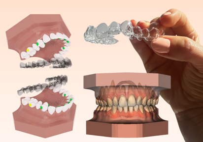 Polorto – Modele de diagnosticare DDP AI