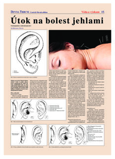 DT Czech and Slovak Republic