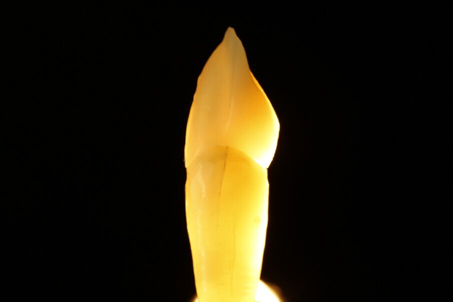 Fig. 12a: Light dynamics of natural teeth in direct and indirect light.