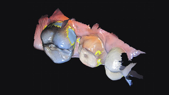 Empreinte optique et fichier ouvert De nouvelles façons de travailler avec son laboratoire