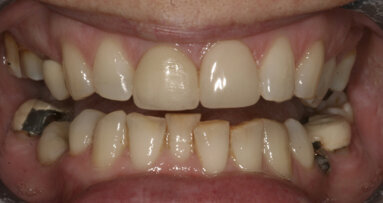 The informed, lifetime patient