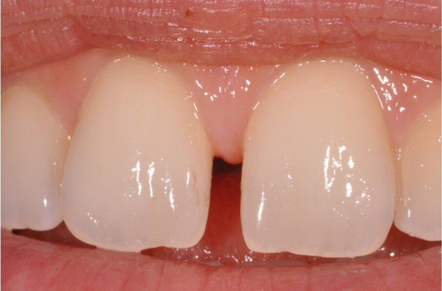 Fig. 2–4: Common troubles with a classic approach.