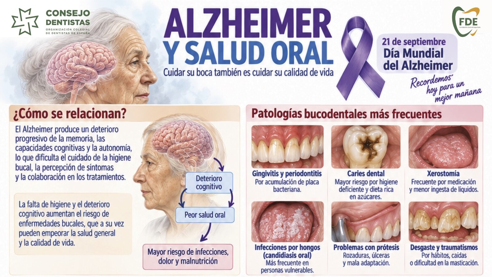 El Alzheimer aumenta el riesgo de problemas bucodentales