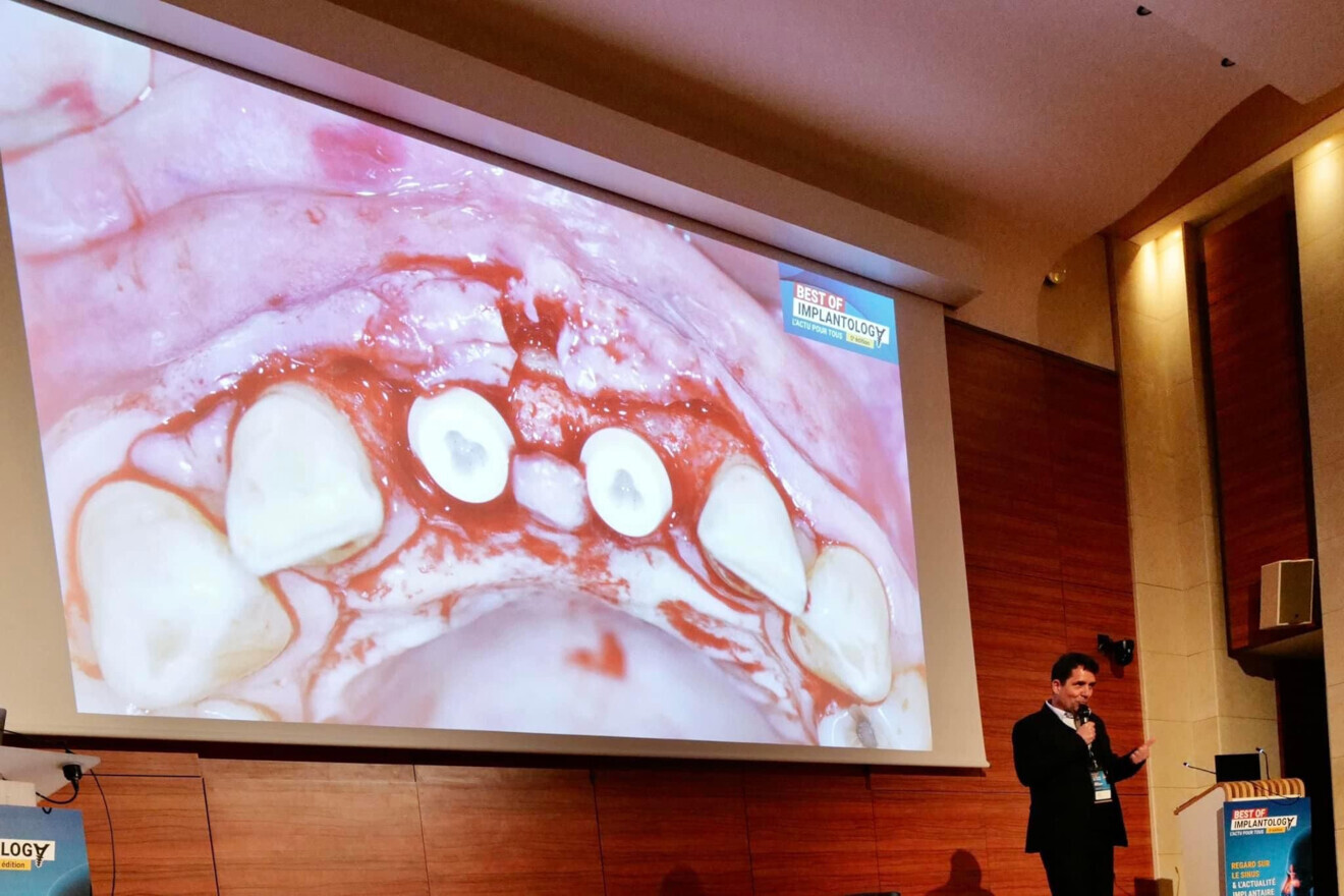 Présentation du Dr Pascal Karsenti au Best Of Implantology 2024. (Photo : Patent) 