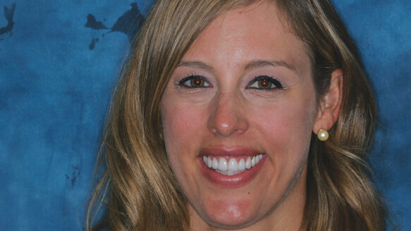 Bite alteration to reduce gummy smiles