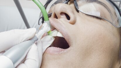 La prevención de la periimplantitis debe comenzar en la planificación de los implantes