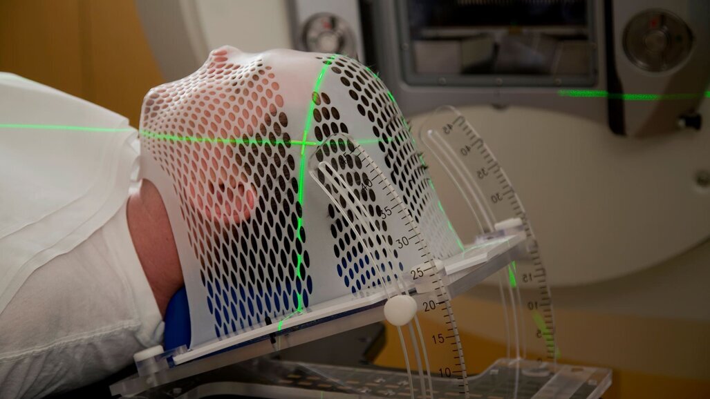 Una buona salute orale è associata a una migliore sopravvivenza nei pazienti affetti da tumore del distretto testa-collo