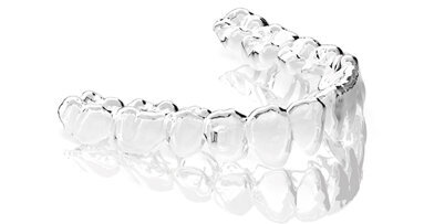 F22 ALIGNER: l’allineatore invisibile