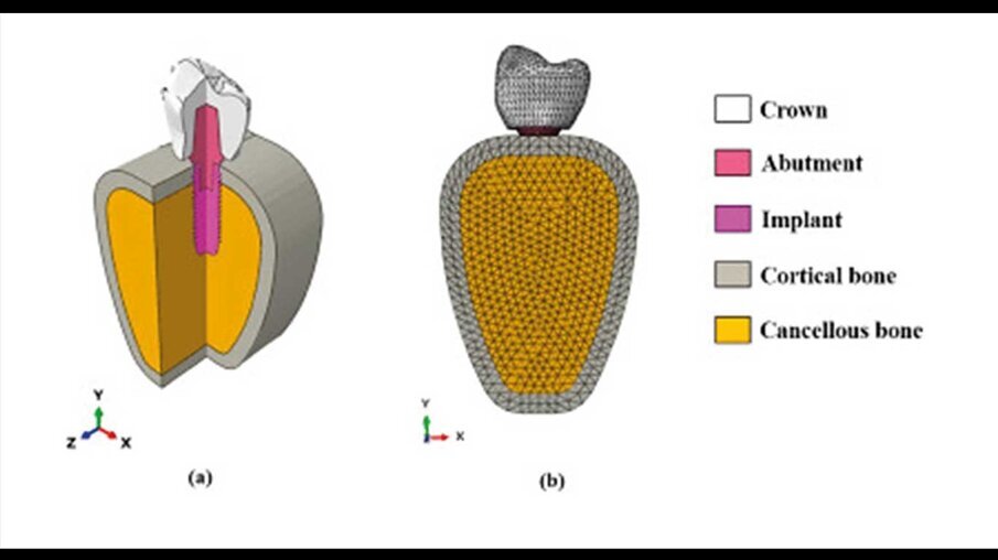 Fig. 6_A) Modello 3D studiato nell'analisi FEM, b) vista in sezione con la discretizzazione effettuata.