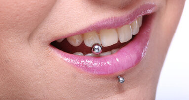 Orale Modetrends und ihre Folgen