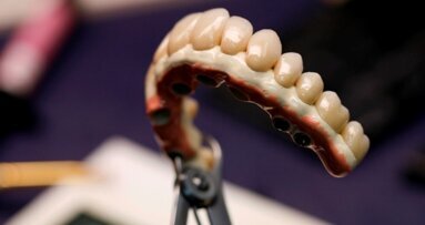 Kompleksowe postępowanie w leczeniu implantologicznym szczęki z zastosowaniem CBCT i CAD/CAM – część 2