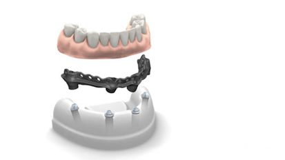 Phibo präsentiert Phixoss & Certia Guide auf der IDS