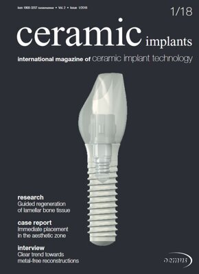 ceramic implants international No. 1, 2018 ceramic implants international No. 1, 2018