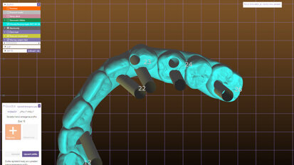 Tipy a triky pro usnadnění práce zubního technika s implantáty