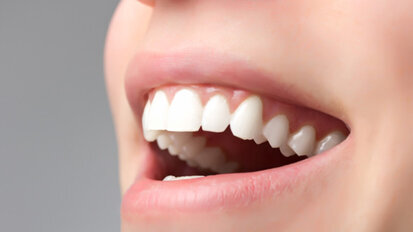 Rheinland-Pfälzer haben gesunde Zähne