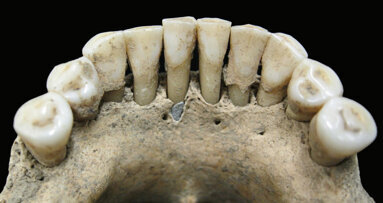 Das verrät Zahnstein über die Rolle der Frau im Mittelalter