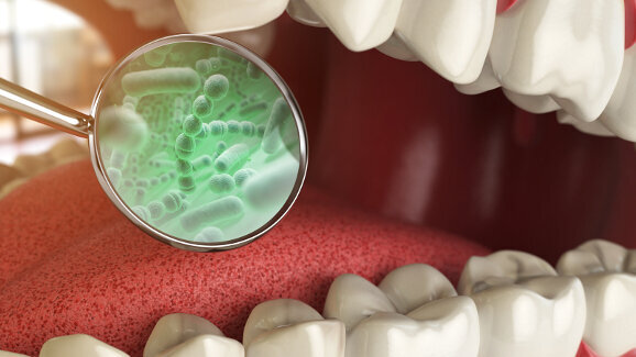 New research targets disease-causing oral bacteria