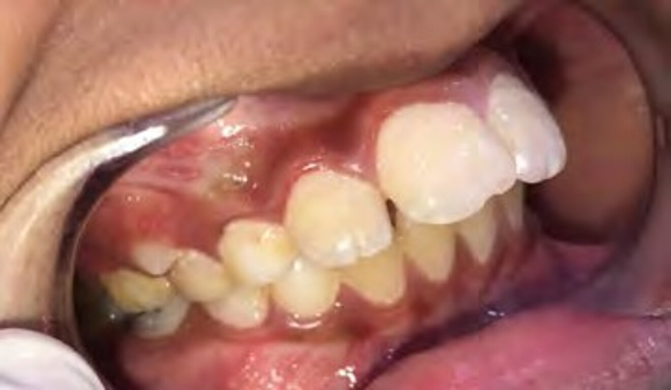 1g
