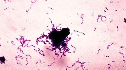 Кариесогенна бактерия може да допринася за разграждането на композиционните материали