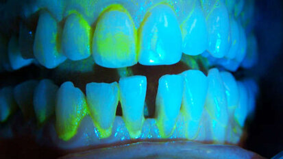 Medicina rigenerativa: perché le più recenti scoperte scientifiche possono tradursi in atti terapeutici