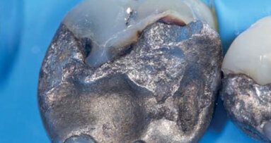 Améliorer vos diagnostics : Que peut-nous apprendre la fluorescence photo-induite ?