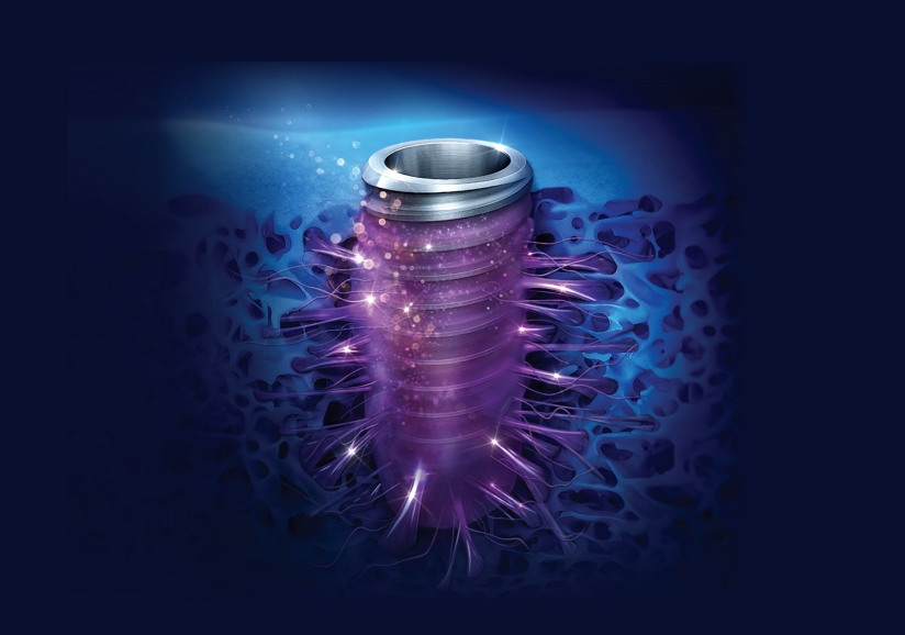 Osstem Implant’s SOI surface technology