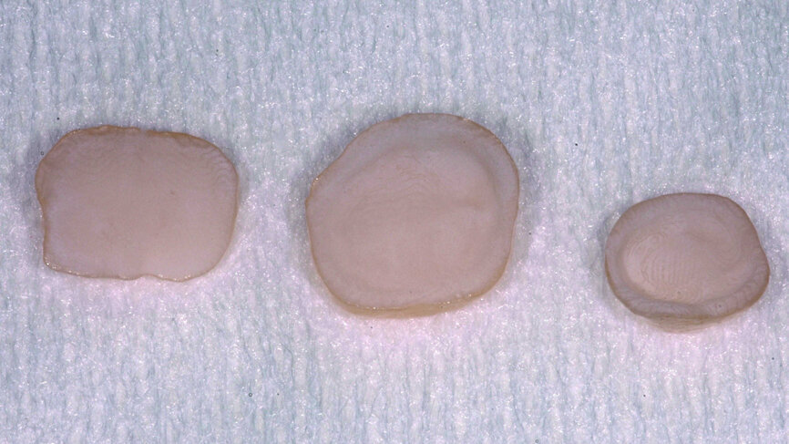Fig. 12 : Intrados rincé, séché puis application d’un silane(Monobond Plus 60 secondes) puis d’un adhésif ExciTE non polymérisé. |