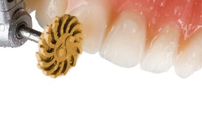 Enhance Flex: la nuova frontiera della finitura e lucidatura dei restauri in composito