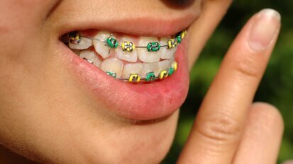 Invloed van beugelbehandeling op weefsel onderzocht