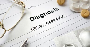 Visualização de fluorescência poderia melhorar as taxas de recidiva do câncer bucal