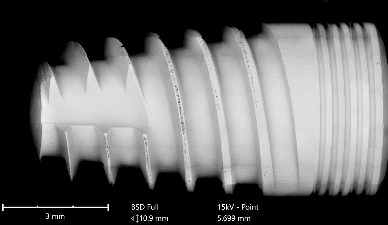 Fig. 3: Factory-related contamination of entire implant threads (Ritter Implants). Full-size SEM image of the implant electronically compiled from hundreds of single images at 500× magnification using the material contrast technique (back-scattered electron mode).