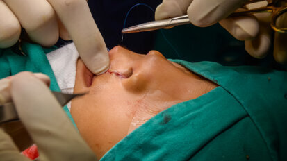 Children with clefts to receive improved oral healthcare