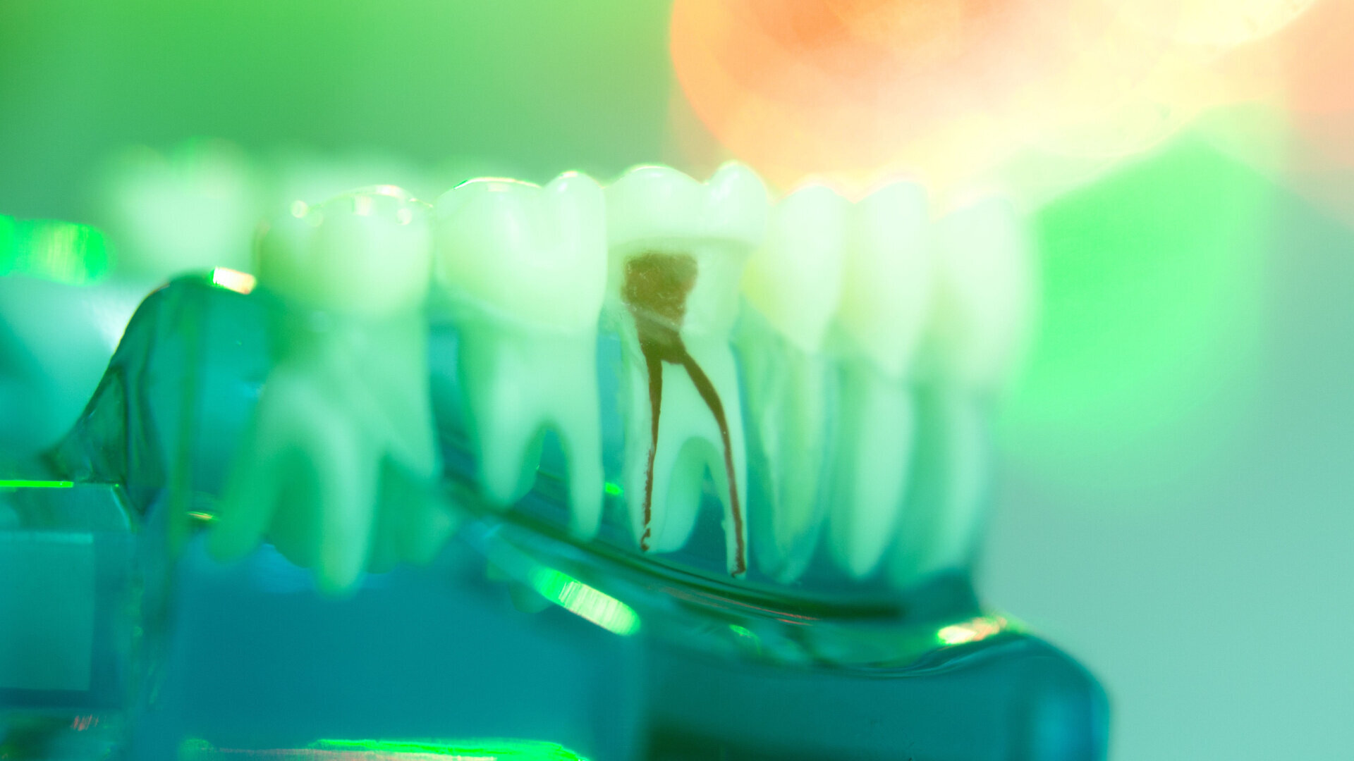 A simple sequence for successful root canal treatment outcomes