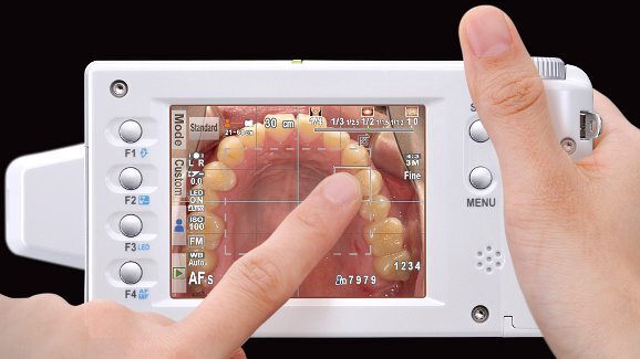 Webinar introduces new option for dental photography