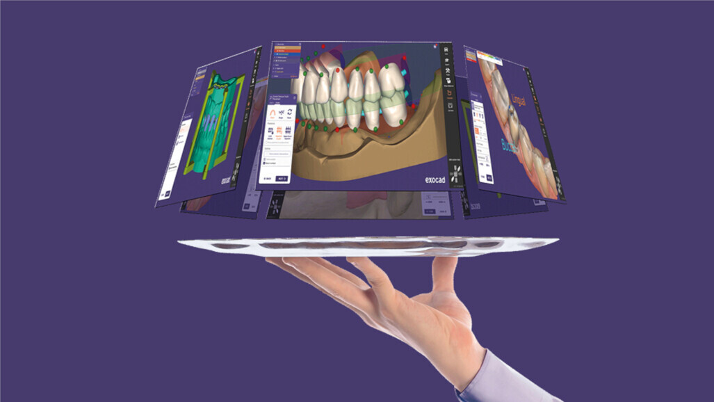 exocad – dentalshare