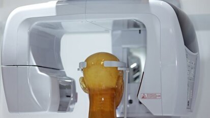 Austrália prestes a alterar regulamentos restritivos de propriedade de CBCT para dentistas