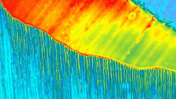 DT Study Club: Webinar behandelt dentale Adhäsivtechnik