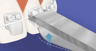 Forma se snoubí s funkcí