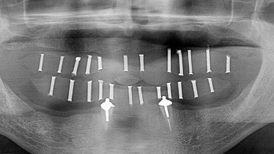 CBCT applications in dental practice: A literature review