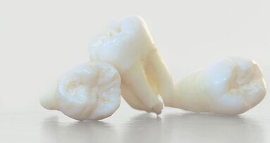 Armen verliezen acht tanden meer dan rijken