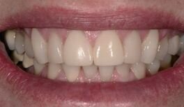 Afbeelding 11: Het eindresultaat na rehydratie. De kernwaarden kwaliteit, efficiency en esthetiek komen hier alle drie aan bod.