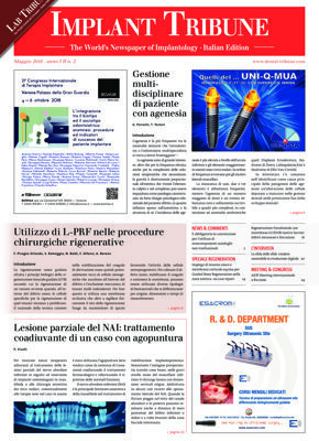 Implant Tribune Italy No. 2, 2018 Implant Tribune Italy No. 2, 2018