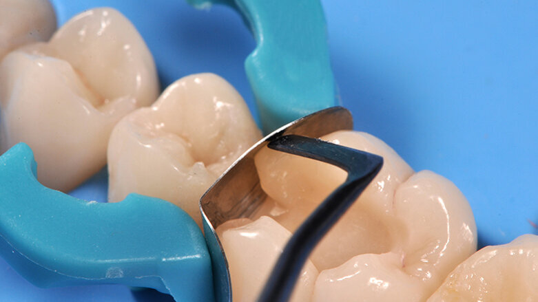 3ssential Kit By Werestore.It: The easiest way for restoratives