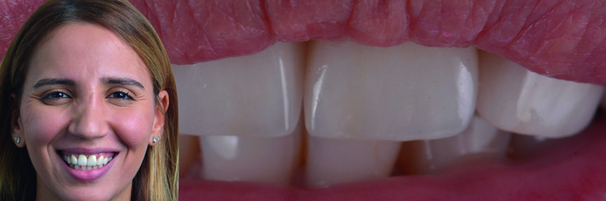 Figs. 33–34 : Résultat final.