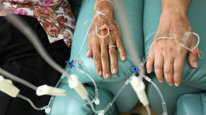 Les patients atteints d’un cancer de la bouche HPV-positif ont de meilleures chances de survie