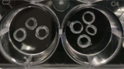 Strontium-loaded scaffold may improve dental implant wound healing